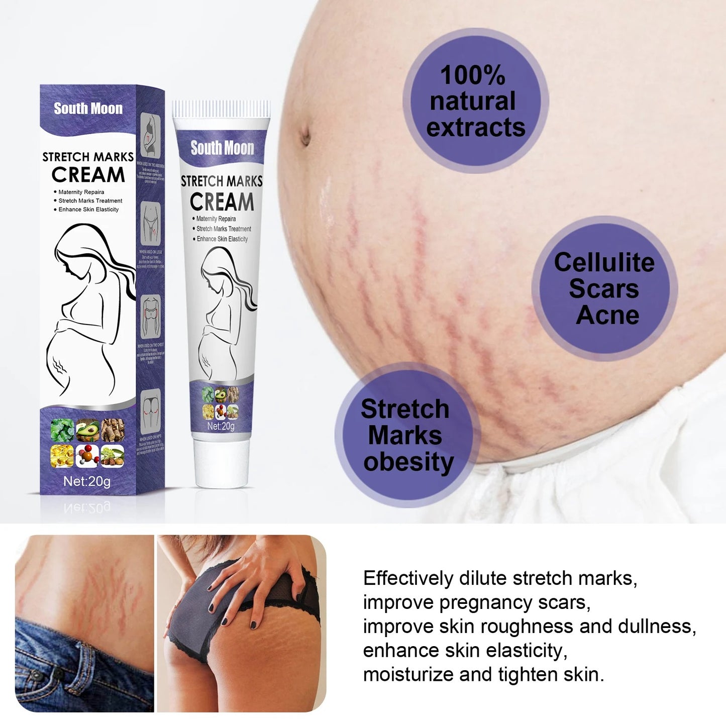 Pregnancy Stretch Marks Cream Improves Elasticity Fade Growth Lines Smoothing Nourishing Moisturizing Firming Skin Care