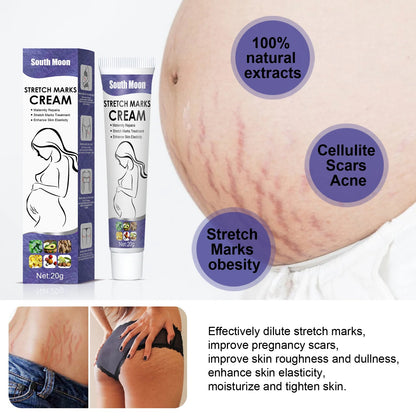 Pregnancy Stretch Marks Cream Improves Elasticity Fade Growth Lines Smoothing Nourishing Moisturizing Firming Skin Care